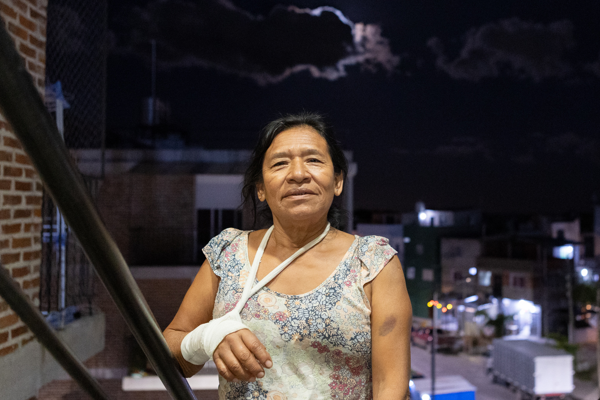 Image of a woman with a cast